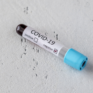 Mitarbeiter der Schlacht- und Zerlegebetriebe in Niedersachsen müssen mindestens alle zehn Tage auf das Corona-Virus getestet werden